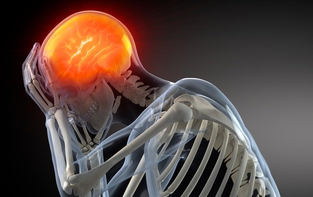 Brain-Disease.jpg