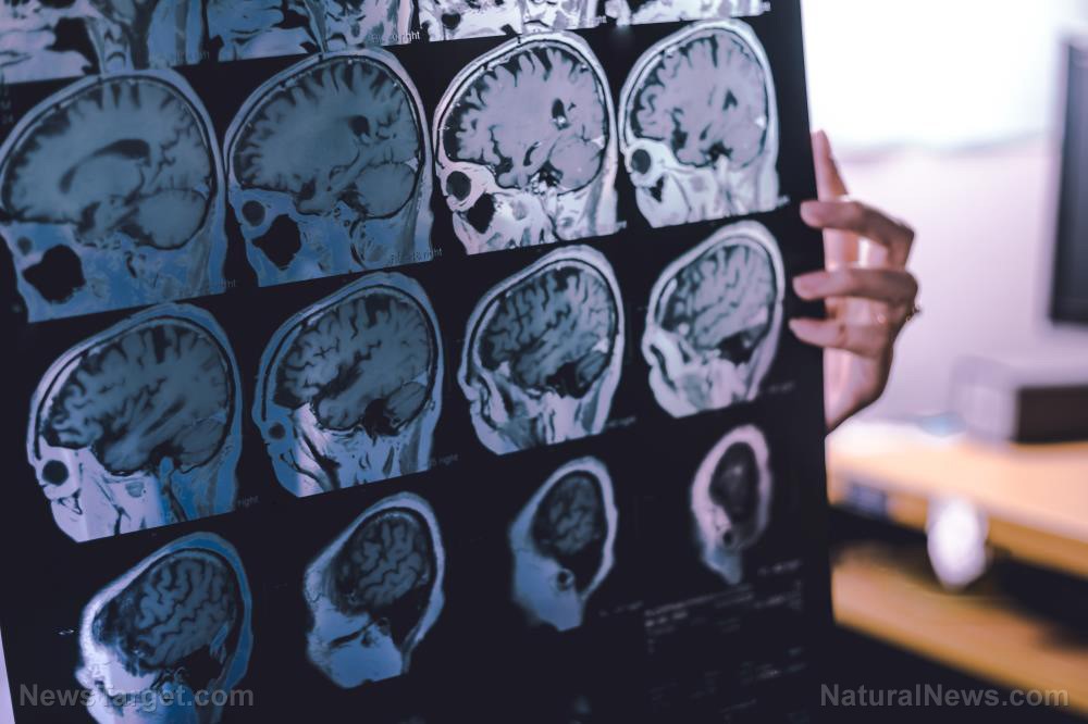 Brain-Spike-Proteins.jpg