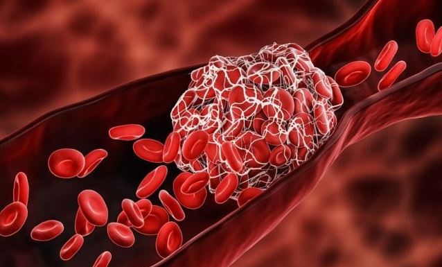 mRNA-and-Myocarditis.jpg